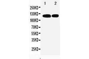 Anti-p107 antibody, Western blotting Lane 1: 239T Cell Lysate Lane 2: JURKAT Cell Lysate (p107 Antikörper  (C-Term))