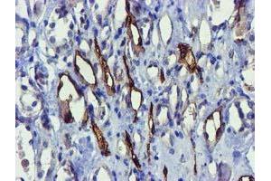 Immunohistochemistry (IHC) image for anti-Family with Sequence Similarity 84, Member B (FAM84B) antibody (ABIN1498212) (FAM84B Antikörper)