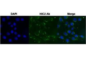 Immunofluorescent staining of Huh7 cell with HIC2 polyclonal antibody  under 4 ug/mL working concentration. (HIC2 Antikörper  (AA 395-444))