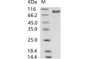 Western Blotting (WB) image for MERS-Coronavirus Spike Protein (MERS-CoV S) (Active) protein (His tag) (ABIN7198816) (MERS-Coronavirus Spike Protein (His tag))