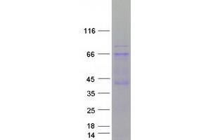 Western Blotting (WB) image for Eukaryotic Translation Initiation Factor 2-alpha Kinase 2 (EIF2AK2) (Transcript Variant 2) protein (Myc-DYKDDDDK Tag) (ABIN2720058)