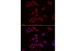 Immunofluorescence analysis of U2OS cells using NPHP1 antibody (ABIN5974022). (NPHP1 Antikörper)