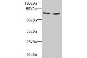 Western blot All lanes: TNFRSF11A antibody at 2 μg/mL Lane 1: EC109 whole cell lysate Lane 2: 293T whole cell lysate Secondary Goat polyclonal to rabbit IgG at 1/15000 dilution Predicted band size: 67, 33, 37, 29, 57, 65 kDa Observed band size: 67 kDa (TNFRSF11A Antikörper  (AA 28-202))