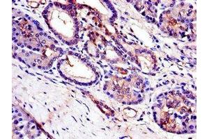 Immunohistochemistry of paraffin-embedded human pancreatic tissue using ABIN7173365 at dilution of 1:100 (TRIB3 Antikörper  (AA 152-325))