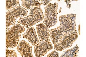 ABIN6260867 and ABIN6266510 at 1/100 staining Rat colon tissue by IHC-P. (Claudin 5 Antikörper  (C-Term))