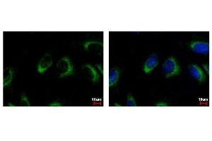 Immunofluorescence (IF) image for anti-NQO2 (NQO2) (Center) antibody (ABIN2856214)
