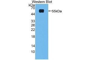 Detection of Recombinant FXR, Rat using Polyclonal Antibody to Farnesoid X Receptor (FXR) (NR1H4 Antikörper  (AA 375-568))