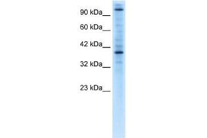 Human Jurkat; WB Suggested Anti-ZNF624 Antibody Titration: 0. (ZNF624 Antikörper  (Middle Region))