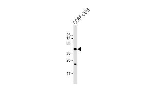 Western Blotting (WB) image for anti-Protein Prenyltransferase alpha Subunit Repeat Containing 1 (PTAR1) (AA 60-89) antibody (ABIN652563)