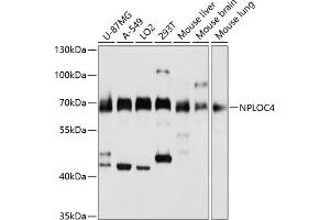 Western blot analysis of extracts of various cell lines, using NPLOC4 antibody (ABIN1681086, ABIN5664262, ABIN5664264 and ABIN6220175) at 1:3000 dilution. (NPLOC4 Antikörper  (AA 1-270))