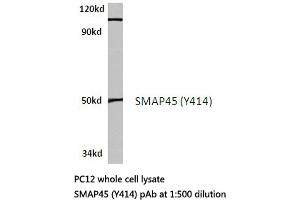 Western blot (WB) analysis of SMAP45 antibody in extracts from PC12 cells. (HDAC3 Antikörper)