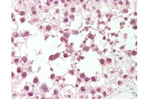 Anti-RANBP2 / TRP1 antibody IHC staining of human testis.