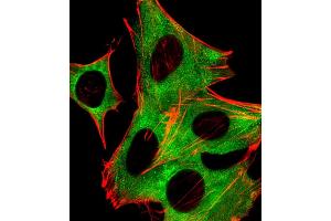 Immunofluorescence (IF) image for anti-Protein Phosphatase 2, Regulatory Subunit B', beta (PPP2R5B) (AA 466-500), (C-Term) antibody (ABIN6243837)