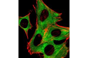 Fluorescent image of SH-SY5Y cells stained with P2R5B Antibody (C-term) (ABIN6243837 and ABIN6577726). (PPP2R5B Antikörper  (C-Term))