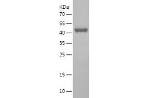 Golgin B1 (GOLGB1) (AA 3007-3192) protein (His-IF2DI Tag)