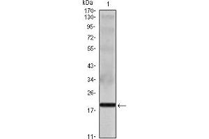 Western blot analysis using IL16 mouse mAb against IL16 recombinant protein. (IL16 Antikörper)