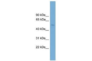 BBS4 antibody used at 1 ug/ml to detect target protein. (BBS4 Antikörper  (Middle Region))