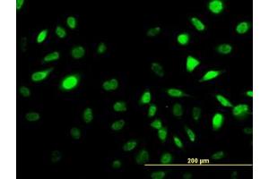Image no. 1 for anti-Sestrin 2 (SESN2) (AA 1-481) antibody (ABIN466250) (Sestrin 2 Antikörper  (AA 1-481))