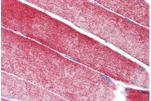 Human Skeletal Muscle: Formalin-Fixed, Paraffin-Embedded (FFPE) (MAP3K10 Antikörper  (AA 110-138))