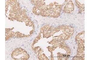 Immunoperoxidase of monoclonal antibody to DCXR on formalin-fixed paraffin-embedded human prostate. (DCXR Antikörper  (AA 145-244))