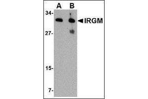 Western blot analysis of IRGM in human brain lysate with this product at (A) 1 and (B) 2 μg/ml.