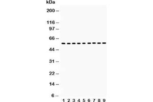Western blot testing of Vimentin antibody and Lane 1:  HT1080;  2: NIH3T3;  3: Jurkat;  4: HUT;  5: MCF-7;  6: HeLa;  7: human placenta;  8: rat testis;  9: mouse testis lysate (Vimentin Antikörper  (C-Term))