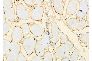 ABIN6259906 and ABIN6276534 at 1/100 staining Mouse muscle tissue by IHC-P. (AMACR Antikörper  (Internal Region))