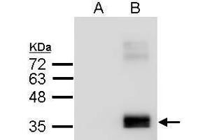 WB Image Sample (2. (APOE Antikörper  (C-Term))