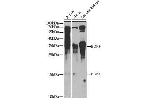 Western blot analysis of extracts of various cell lines, using BDNF antibody (ABIN6129991, ABIN6137522, ABIN6137524 and ABIN6215043) at 1:1000 dilution. (BDNF Antikörper  (AA 20-247))
