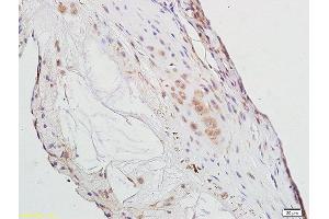 Formalin-fixed and paraffin embedded rat aorta tissue labeled with Anti-PPAR Gamma Polyclonal Antibody, Unconjugated (ABIN1386283) at 1:300 followed by conjugation to the secondary antibody (PPARG Antikörper  (AA 315-420))