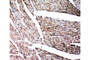 Immunohistochemistry (IHC) image for anti-Gelsolin (GSN) (AA 763-775) antibody (ABIN3031036)