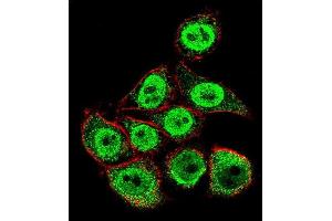Confocal immunofluorescent analysis of TYSY Antibody (C-term) (ABIN1882144 and ABIN2840937) with Hela cell followed by Alexa Fluor 488-conjugated goat anti-rabbit lgG (green). (TYMS Antikörper  (C-Term))