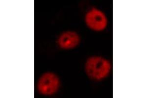 ABIN6269101 staining MOLT by IF/ICC. (Retinoblastoma 1 Antikörper  (C-Term))