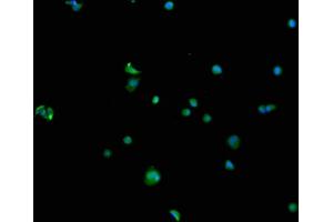 Immunofluorescence staining of MCF-7 cells with ABIN7168807 at 1:100, counter-stained with DAPI. (SEMA4F Antikörper  (AA 417-659))