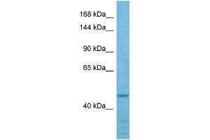 Western Blotting (WB) image for anti-Formin-Like 2 (FMNL2) (Middle Region) antibody (ABIN2790212) (FMNL2 Antikörper  (Middle Region))