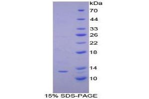 SDS-PAGE analysis of Dog IP10 Protein.
