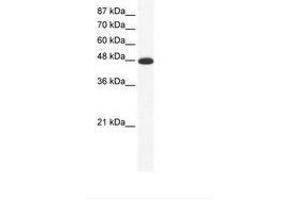 Image no. 1 for anti-Amiloride-Sensitive Cation Channel 5, Intestinal (ACCN5) (AA 201-250) antibody (ABIN202676) (ACCN5 Antikörper  (AA 201-250))