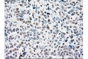 Immunohistochemical staining of paraffin-embedded colon tissue using anti-NRBP1mouse monoclonal antibody.