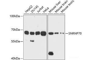 Western blot analysis of extracts of various cell lines using SNRNP70 Polyclonal Antibody at dilution of 1:1000. (SNRNP70 Antikörper)