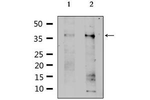 Western blot analysis of extracts from various samples, using SLC39A1 Antibody.