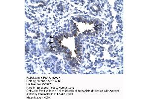 Rabbit Anti-KIF5A antibody   Paraffin Embedded Tissue: Human Lung cell Cellular Data: bronchiole epithelium of renal tubule Antibody Concentration: 4. (KIF5A Antikörper  (Middle Region))
