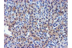 Image no. 2 for anti-Metalloproteinase Inhibitor 2 (TIMP2) antibody (ABIN1501394) (TIMP2 Antikörper)