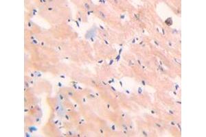 IHC-P analysis of Kidney tissue, with DAB staining.