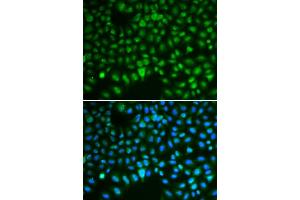 Immunofluorescence analysis of HeLa cells using DLG antibody (ABIN6130274, ABIN6139656, ABIN6139657 and ABIN6217626). (DLGAP5 Antikörper  (AA 547-846))