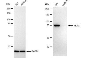 Western blotting analysis using MCM7 antibody (ABIN7799424).