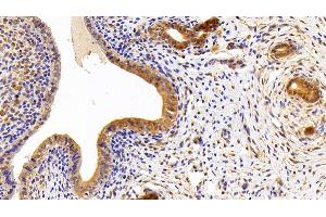 Detection of LPIN1 in Rat Uterus Tissue using Polyclonal Antibody to Lipin 1 (LPIN1)