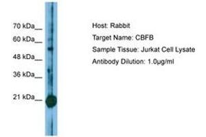 Image no. 1 for anti-Core-Binding Factor, beta Subunit (CBFB) (N-Term) antibody (ABIN6749810) (CBFB Antikörper  (N-Term))