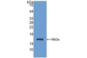 Detection of Recombinant MT1, Human using Polyclonal Antibody to Metallothionein 1 (MT1) (MT1 Antikörper  (AA 1-61))