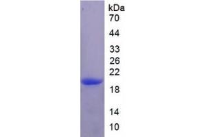 SDS-PAGE analysis of Rat IL17RE Protein.