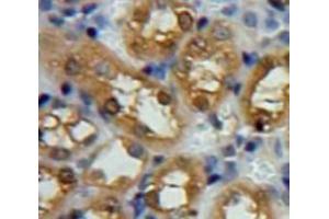 Used in DAB staining on fromalin fixed paraffin-embedded Kidney tissue (SNCG Antikörper  (AA 1-115))